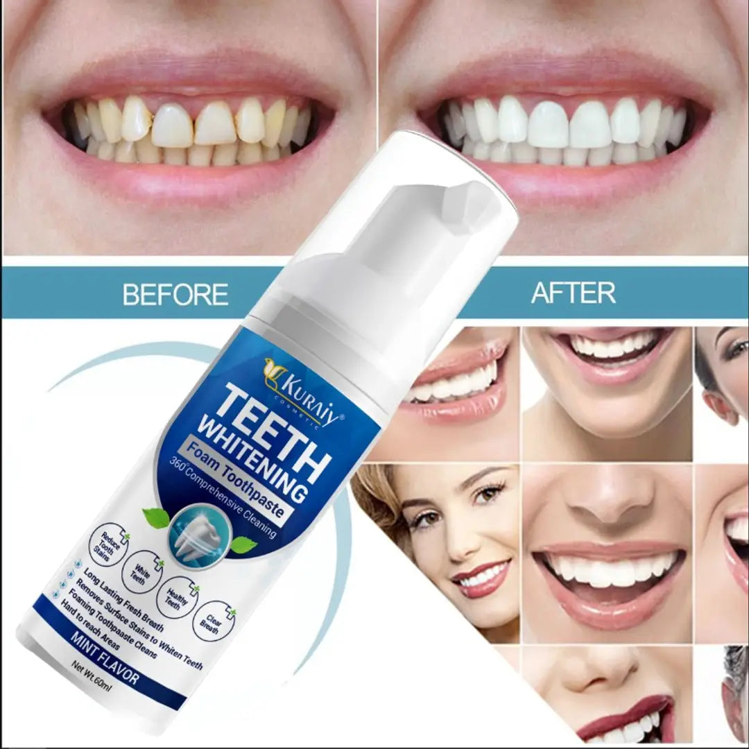 Teeth Whitening Foam