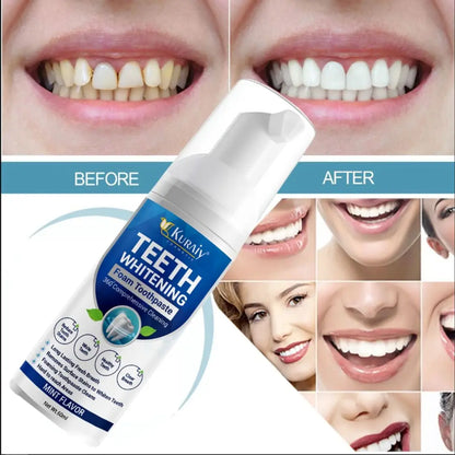 Teeth Whitening Foam