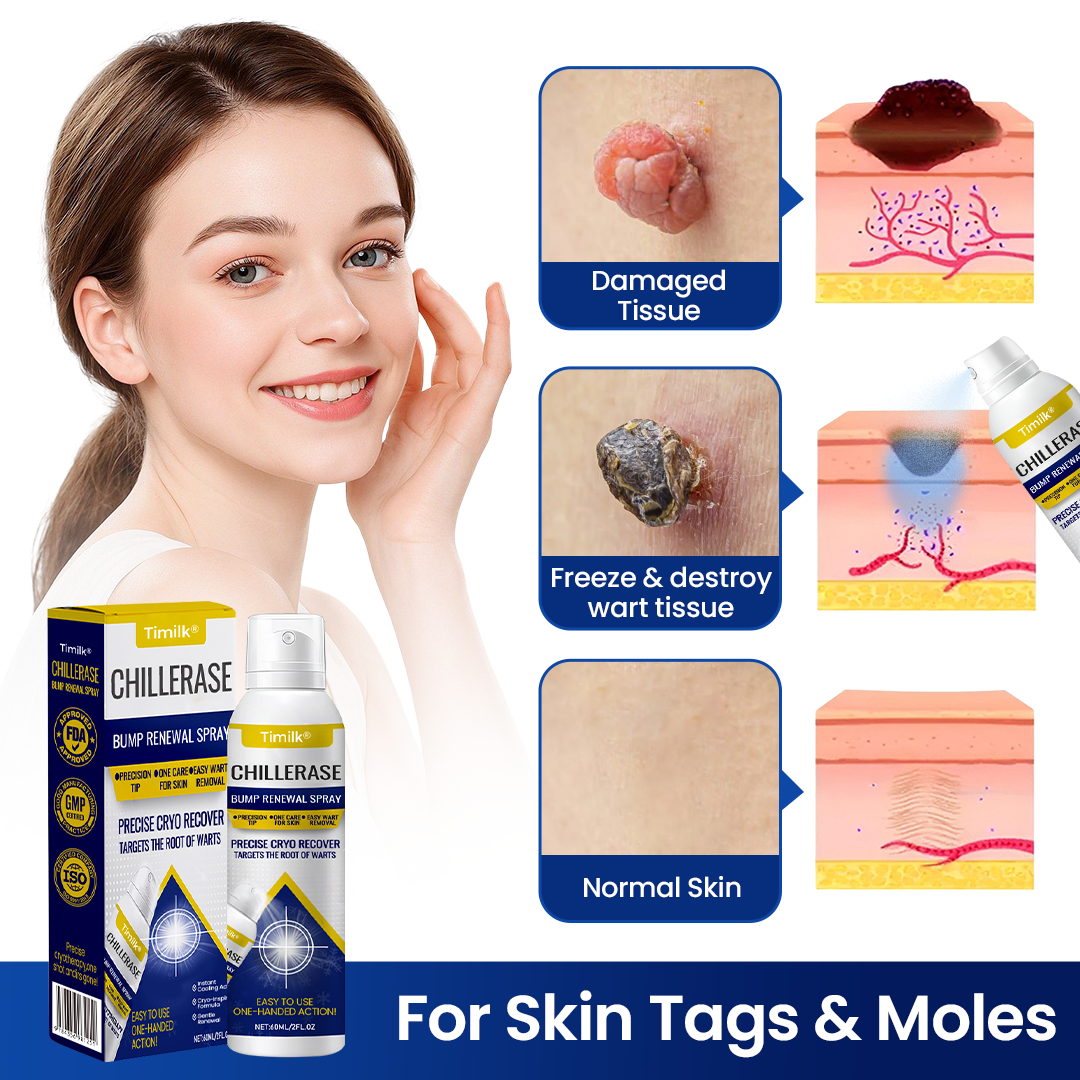 ChillErase Bump Renewal Spray (BUY 1 GET 1 FREE)
