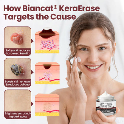 KeraErase Dual-Action Renewal Cream (BUY 1 GET 2)