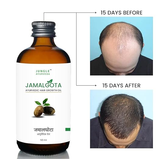 Jamalgota Ayurvedic Hair Growth Oil (Pack of 2 | 1 Month Course)