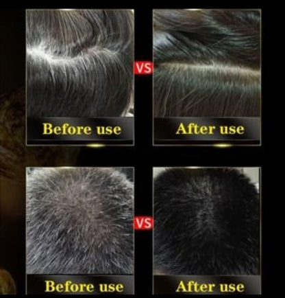 Black Hair Shampoo (Pack of 3)