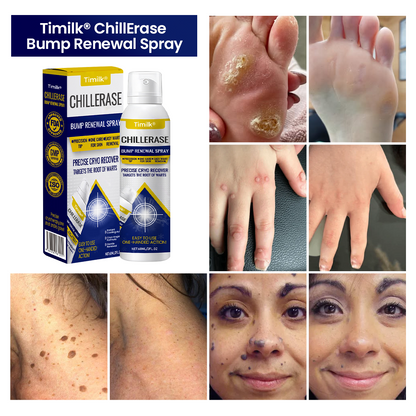 ChillErase Bump Renewal Spray (BUY 1 GET 1 FREE)