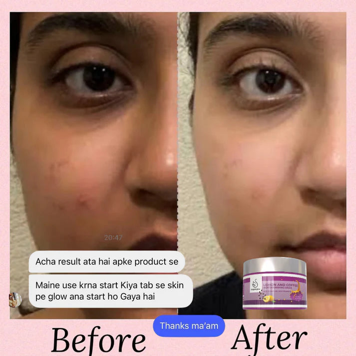 Bright & Glow Day & Night cream Combo(Pack of 2)